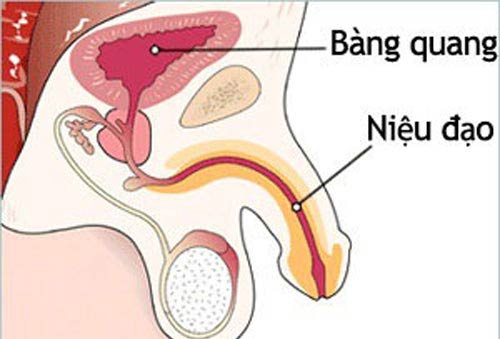 Bệnh viêm niệu đạo