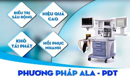 Chữa sùi mào gà bằng phương pháp ALA – PDT