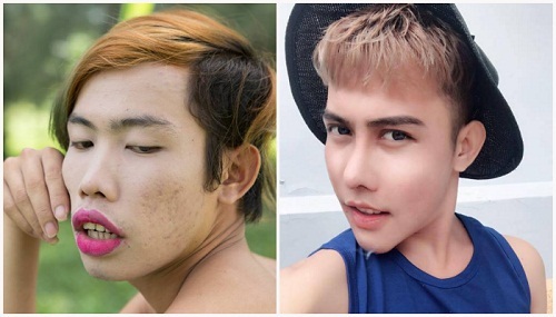 Sửa mũi phá tướng ? Làm Mũi Đẹp cả về Tướng Số lẫn Thẩm Mỹ - Hình 4