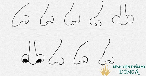 Sửa mũi phá tướng ? Làm Mũi Đẹp cả về Tướng Số lẫn Thẩm Mỹ - Hình 3