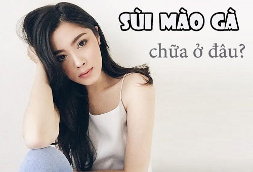 Chi phí chữa bệnh sùi mào gà phụ thuộc vào chọn phương pháp điều trị