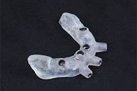 Dental implant surgical guide