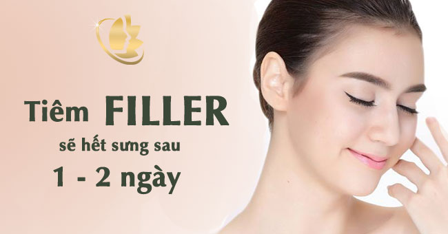 tiêm filler mũi sưng mấy ngày