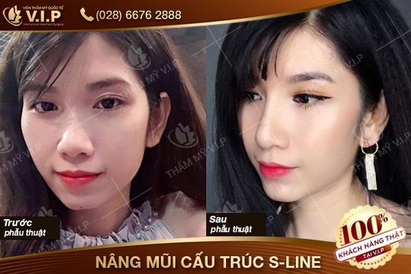 khuyến mãi thẩm mỹ