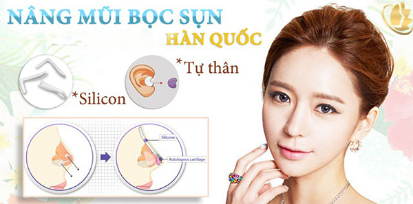 nâng mũi bọc sụn ở đâu đẹp