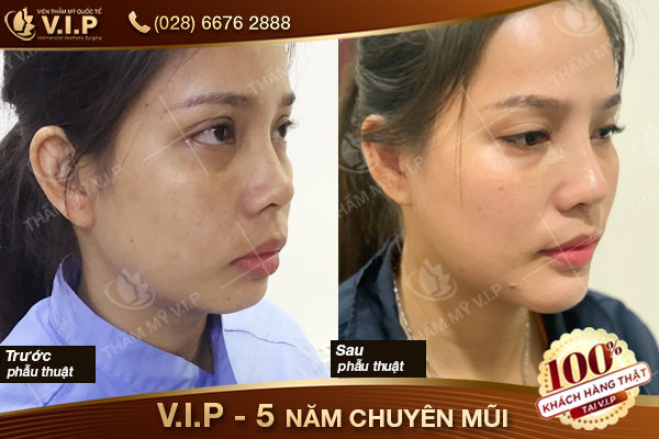 khách hàng tại thẩm mỹ vip