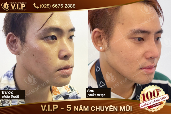 khách hàng tại thẩm mỹ vip