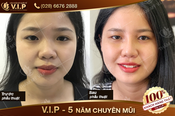 khách hàng tại thẩm mỹ vip