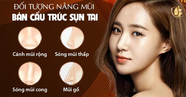 đối tượng nâng mũi bán cấu trúc