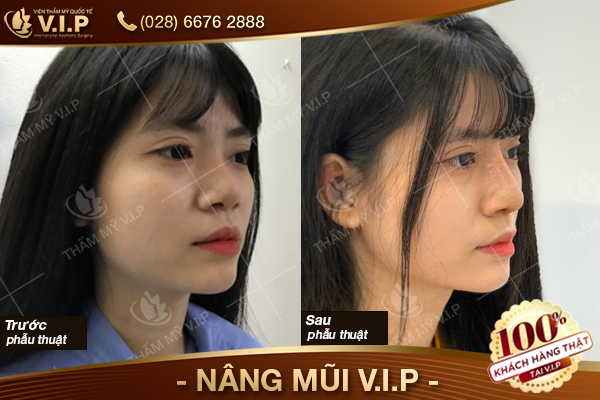 thẩm mỹ vip khách hàng