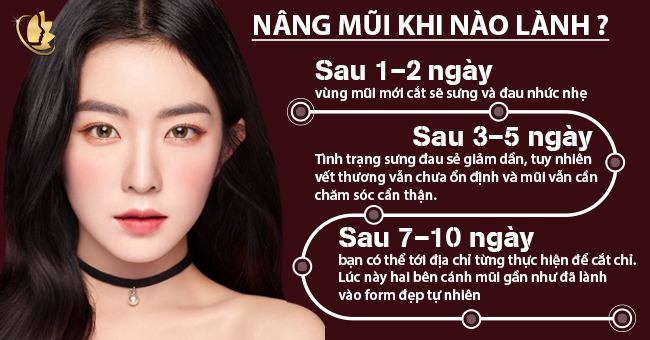 Thời gian phục hồi của nâng mũi bao lâu thì đẹp