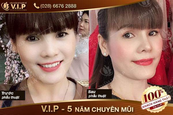 khách hàng thẩm mỹ vip