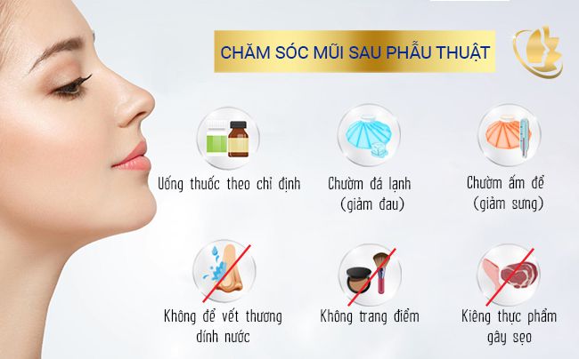 cách chăm sóc nâng mũi bao lâu hết sưng nhanh chóng