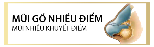 mũi gồ nhiều điễm