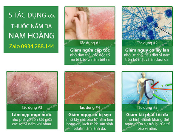 ngứa bìu tinh hoàn