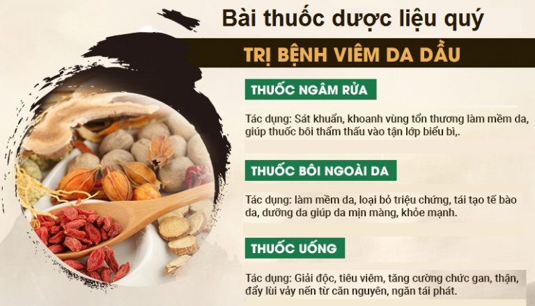 trị viêm da tiết bã nhờn bằng đông y