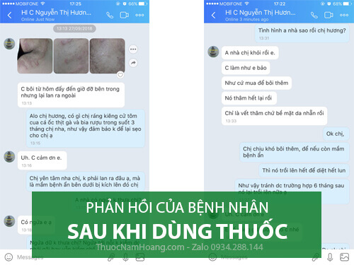 phản hồi về bệnh chàm