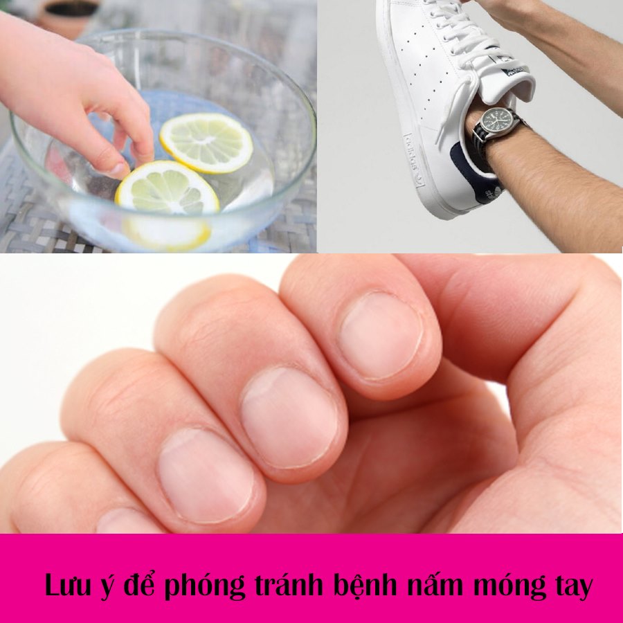 vê sinh khi bị nấm móng tay