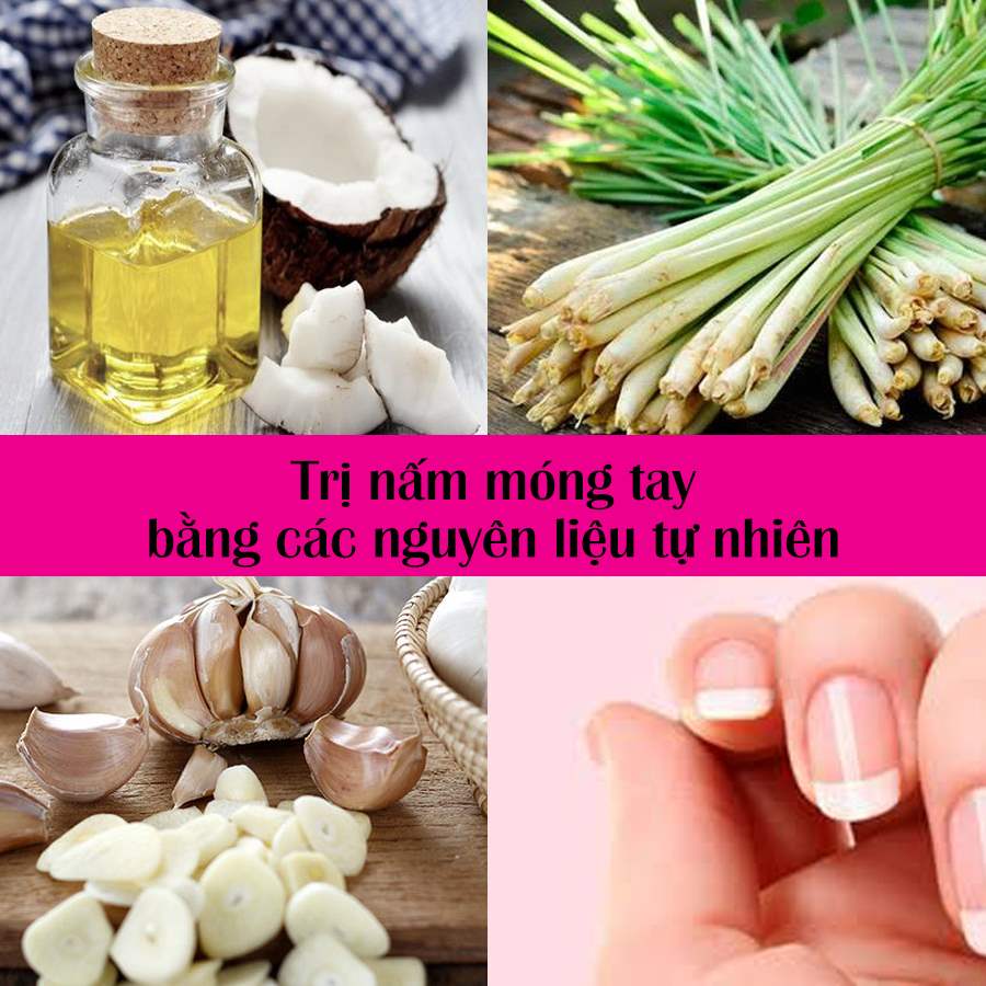 chữa nấm móng tay bằng dân gian