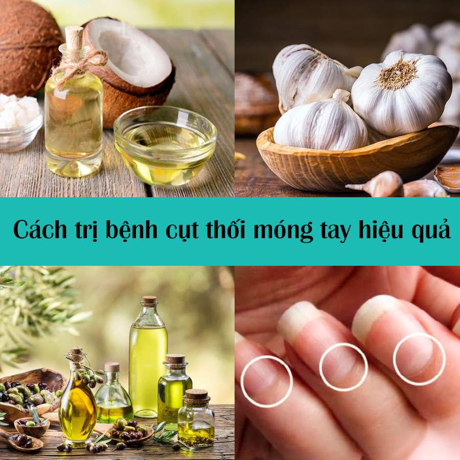 chữa cụt thối móng tay tại nhà