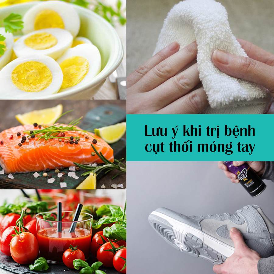 lưu ý khi bị cụt thối móng tay