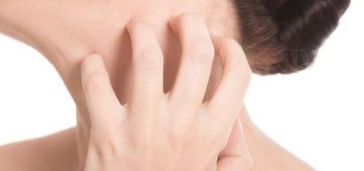bà bầu bị hắc lào phải làm sao