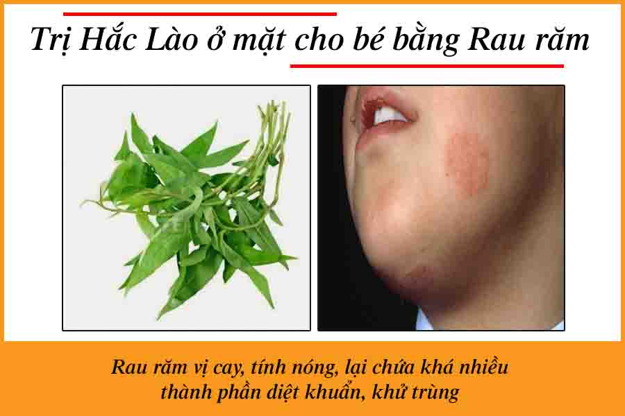 chữa hắc lào trên mặt bằng rau răm