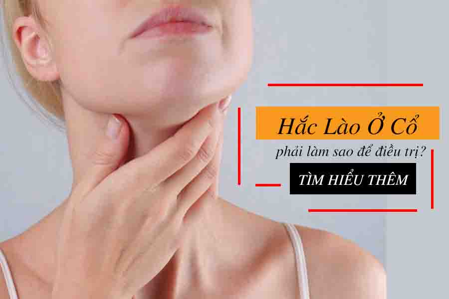 cách trị hắc lào ở cổ