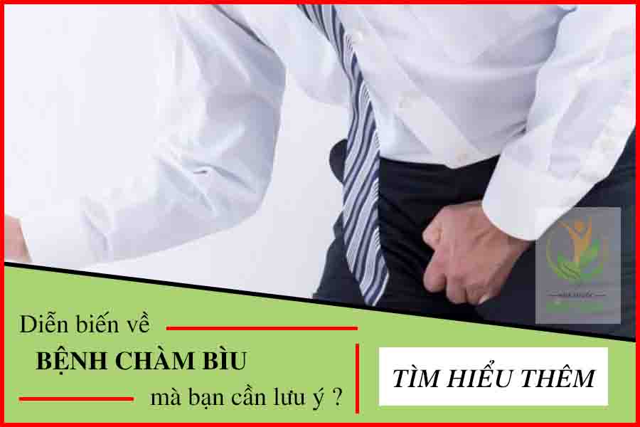 bệnh chàm bìu