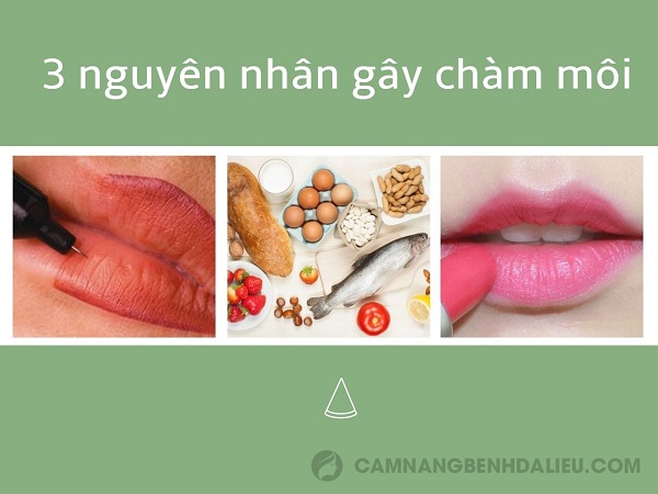 nguyên nhân chàm môi