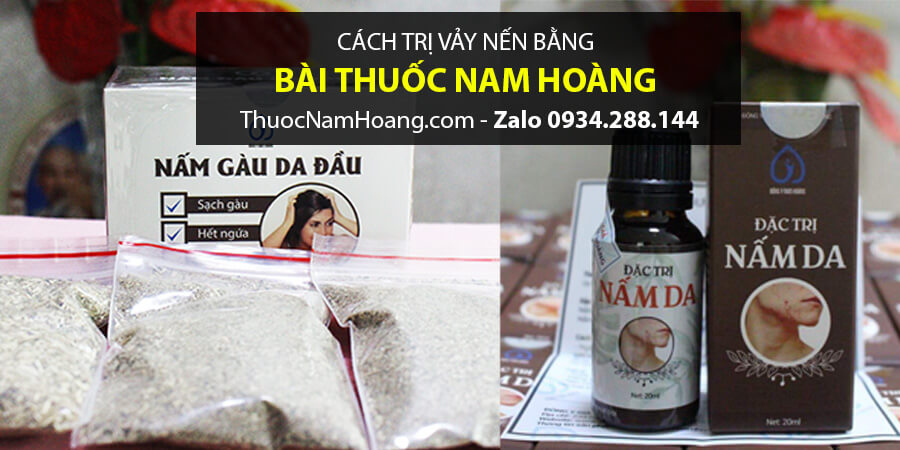 thuốc trị vảy nến da đầu
