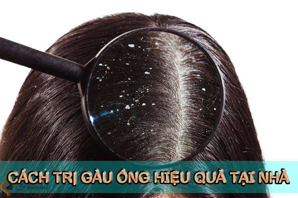 cách trị gàu ống