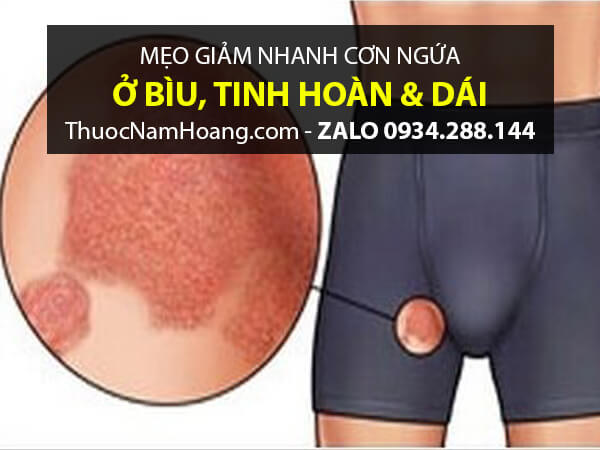 ngứa bìu tinh hoàn về đêm