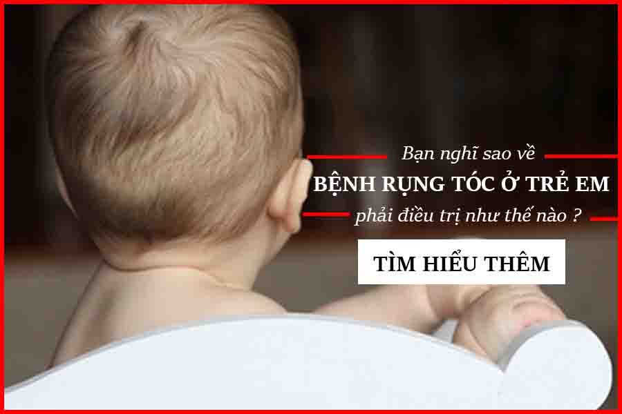 bệnh rụng tóc ở trẻ em
