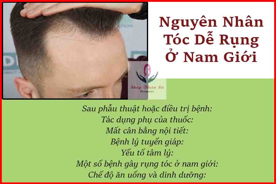 nguyên nhân tóc dễ rụng ở nam giới