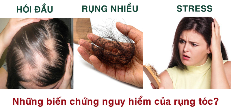 cách trị rụng tóc