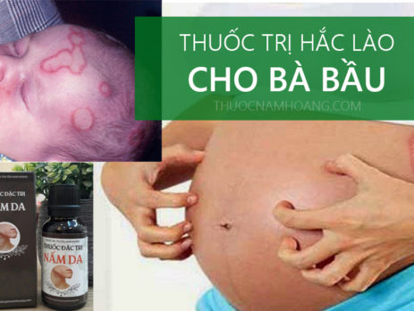 Thuốc trị hắc lào cho bà bầu