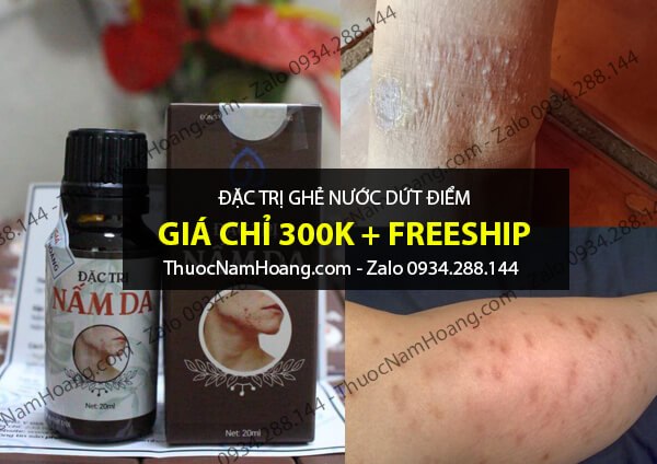 thuốc trị ghẻ nước