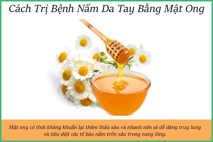 cách trị nấm da tay bằng mật ong
