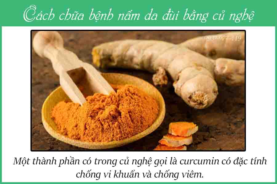trị nấm da đùi bằng nghệ