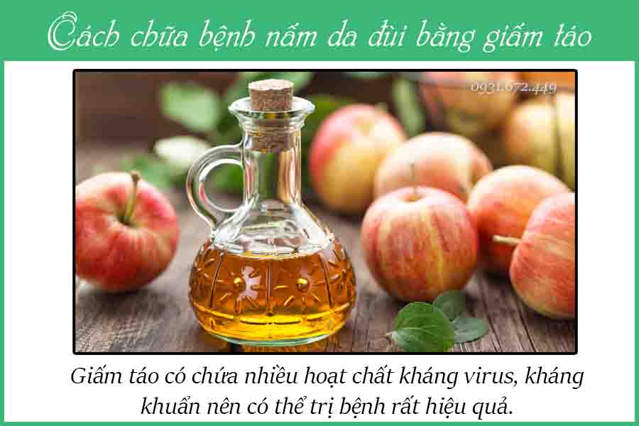 nấm da dùi trị bằng dấm táo