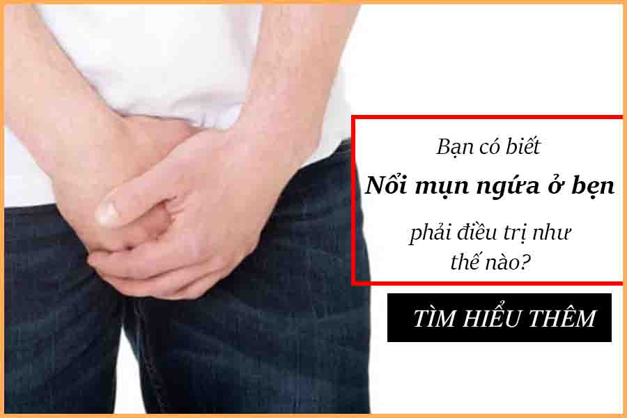 nổi mụn ngứa ở bẹn