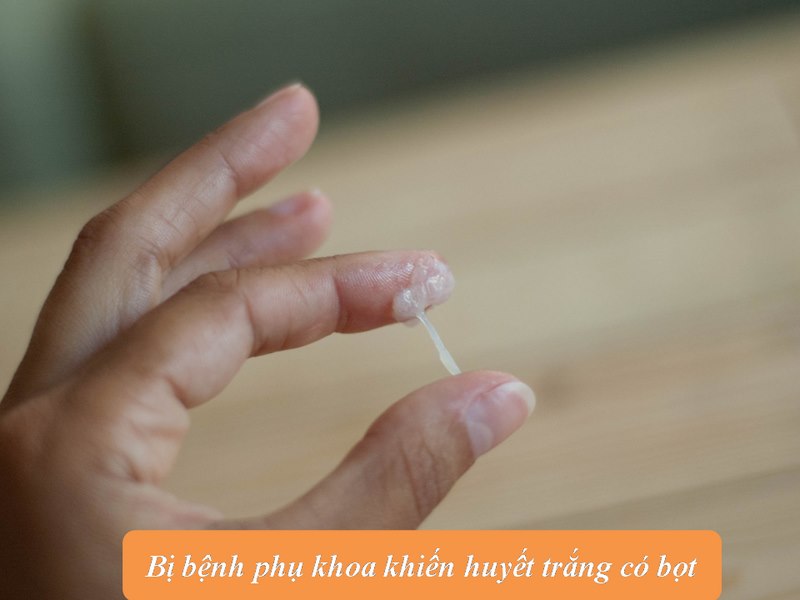 huyết trắng có bọt