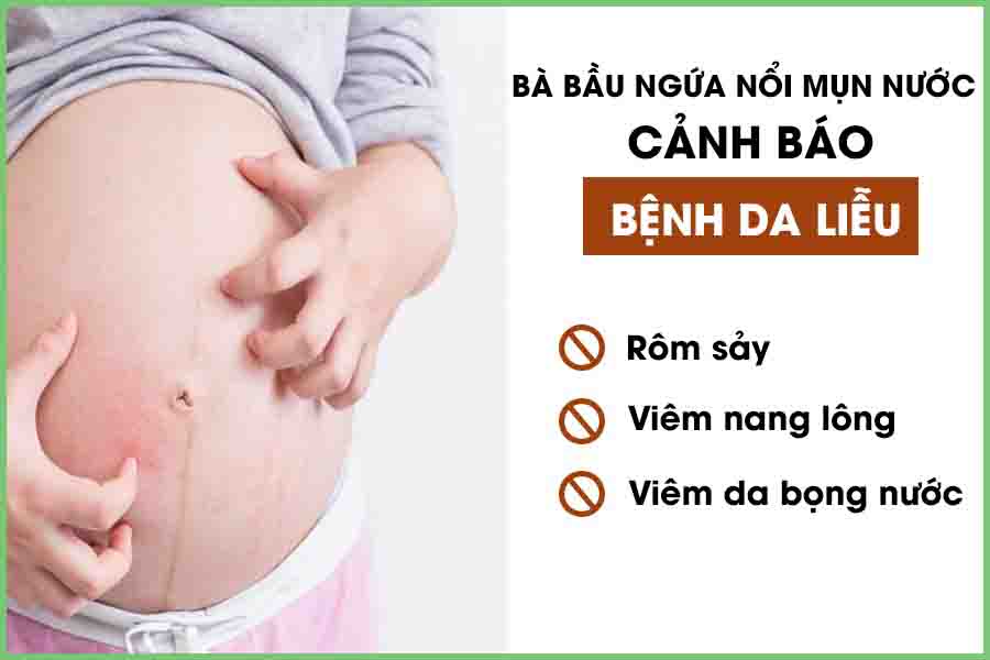 Bà bầu bị ngứa nổi mụn nước