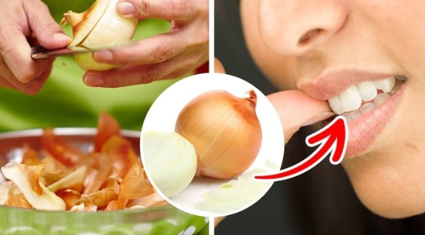 cách chữa đau răng khôn bằng hành tây
