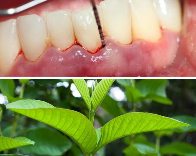 dùng lá ổi trị sưng nướu