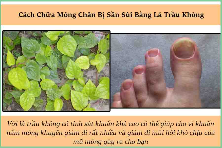 lá trầu không trị móng chân sần sùi