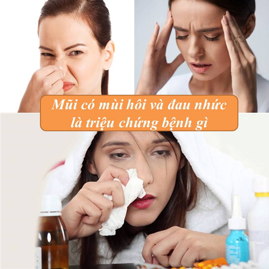 Mũi có mùi hôi thối và bị đau nhức
