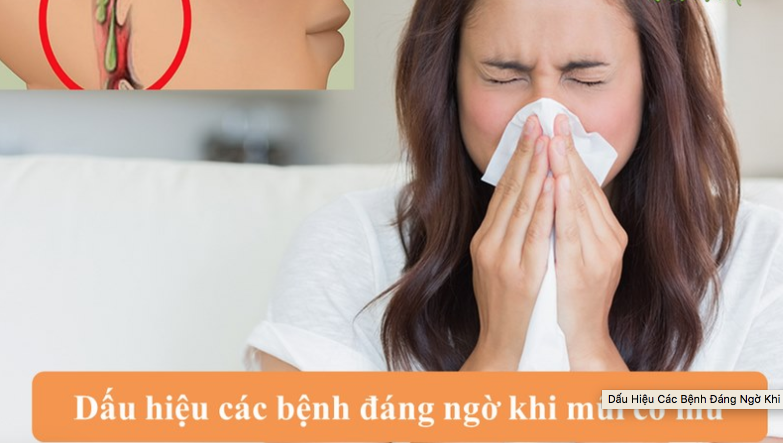 điều tri mũi có mùi hôi như thế nào
