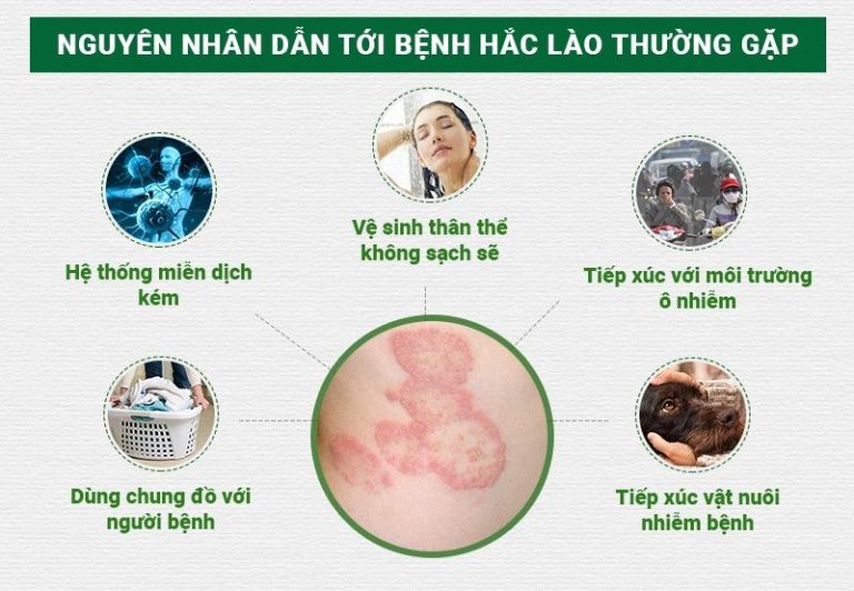 nguyên nhân bị lác đồng tiền